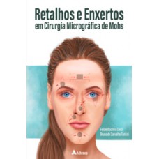 RETALHOS E ENXERTOS EM CIRURGIA MICROGRÁFICA DE MOHS