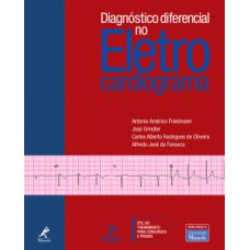 DIAGNÓSTICO DIFERENCIAL NO ELETROCARDIOGRAMA