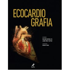 ECOCARDIOGRAFIA