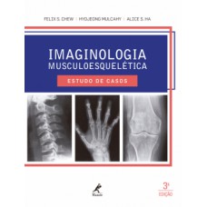 IMAGINOLOGIA MUSCULOESQUELÉTICA: ESTUDO DE CASOS