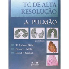 TC DE ALTA RESOLUÇÃO DO PULMÃO