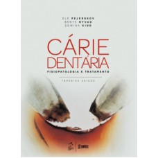 CÁRIE DENTÁRIA: FISIOPATOLOGIA E TRATAMENTO