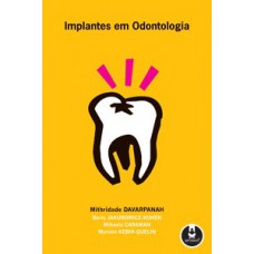 IMPLANTES EM ODONTOLOGIA