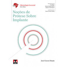 Noções de Prótese Sobre Implante