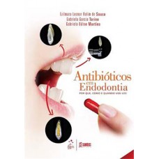 ANTIBIÓTICOS EM ENDODONTIA: POR QUE, COMO E QUANDO USÁ-LOS