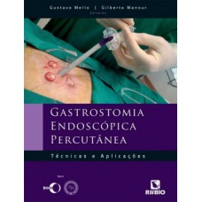 GASTROSTOMIA ENDOSCOPICA PERCUTANEA