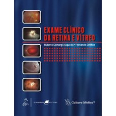 EXAME CLÍNICO DA RETINA E VITREO