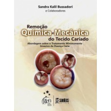 REMOÇÃO QUÍMICA E MECÂNICA DO TECIDO CARIADO: ABORDAGEM SOBRE O TRATAMENTO MINIMAMENTE INVASIVO DA DOENÇA CÁRIE