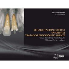 REHABILITACIÓN ESTÉTICA EN DIENTES TRATADOS ENDODÓNTICAMENTE: POSTES DE FIBRA Y POSIBILIDADES CLÍNICAS CONSERVADORAS