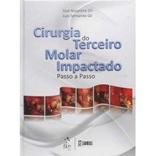 CIRURGIA DO TERCEIRO MOLAR IMPACTADO: PASSO A PASSO