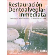 RESTAURACIÓN DENTOALVEOLAR INMEDIATA: IMPLANTES CON CARGA INMEDIATA EN ALVEOLOS COMPROMETIDOS