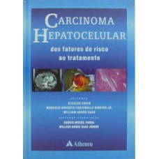 CARCINOMA HEPATOCELULAR: DOS FATORES DE RISCO AO TRATAMENTO