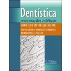 Dentistica Restauracoes Esteticas