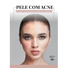 Pele com acne: conceito, tratamento e protocolos estéticos