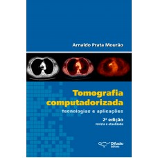 Tomografia computadorizada: tecnologias e aplicações