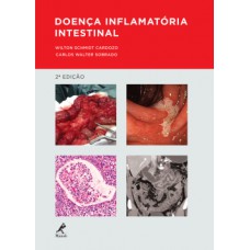 DOENÇA INFLAMATÓRIA INTESTINAL