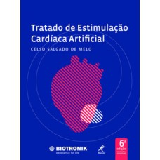 TRATADO DE ESTIMULAÇÃO CARDÍACA ARTIFICIAL