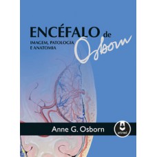 ENCEFALO DE OSBORN - IMAGEM, PATOLOGIA